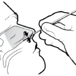 Probe mit sterilem Tupfer aus Nasenloch entnehmen